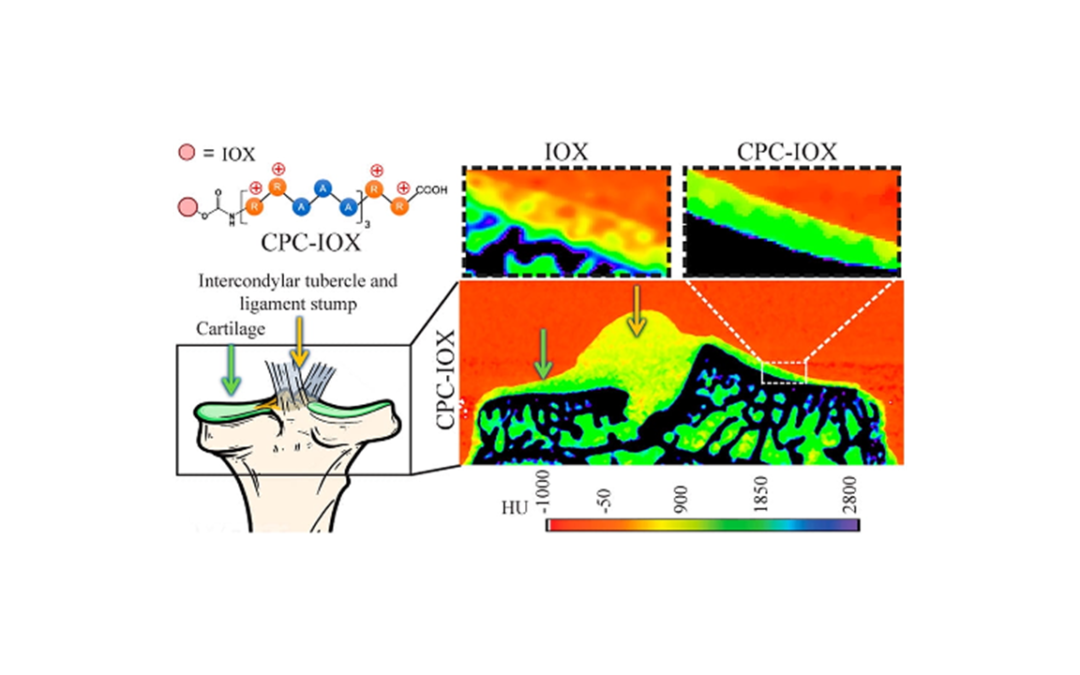 Read our new ACS Nano publication about CT imaging for Cartilage! 📄