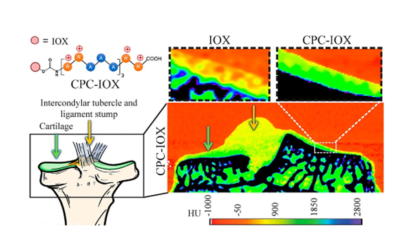 Read our new ACS Nano publication about CT imaging for Cartilage! 📄