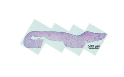 Shikhar Mehta published in Arthritis Research & Therapy!