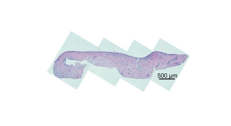 Shikhar Mehta published in Arthritis Research & Therapy!