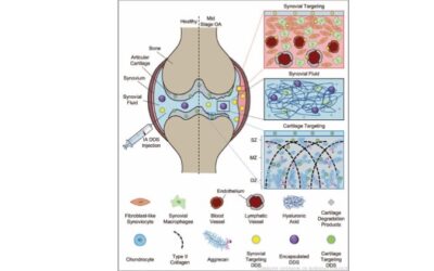 Recent advances in targeted drug delivery for treatment of osteoarthritis