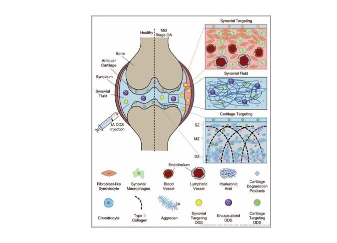 Recent advances in targeted drug delivery for treatment of osteoarthritis