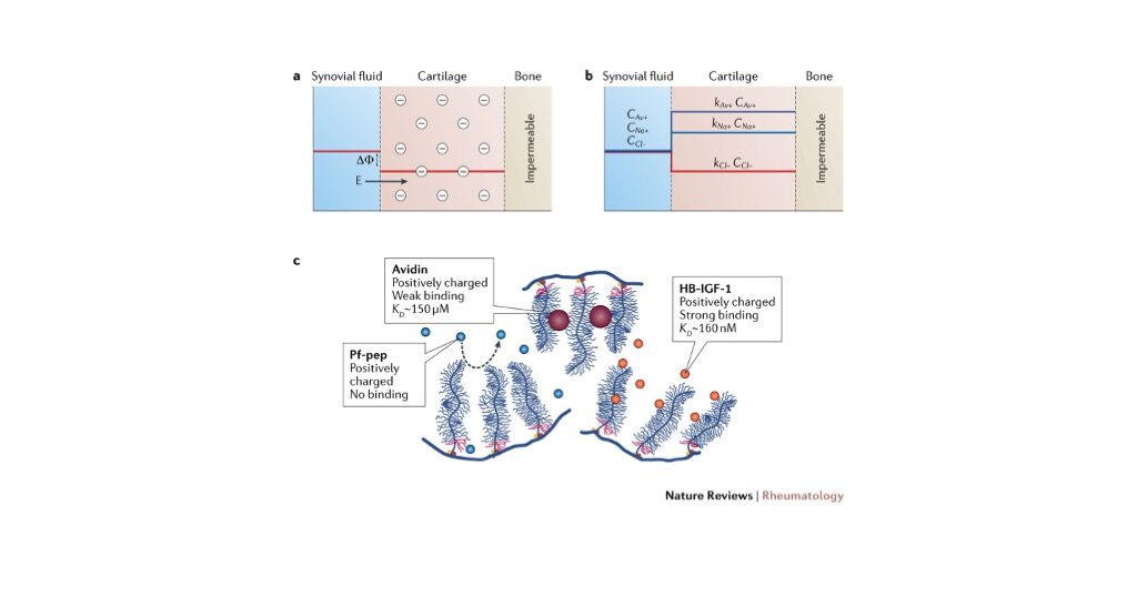 Check out our new paper in Nature Rheumatology Reviews