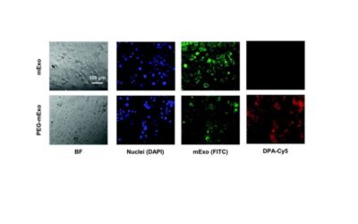 Congrats to Matt Warren and Chenzhen Zhang for their new paper on milk exosomes for oral gene delivery in collaboration with Sanofi!