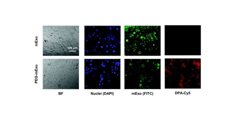 Congrats to Matt Warren and Chenzhen Zhang for their new paper on milk exosomes for oral gene delivery in collaboration with Sanofi!