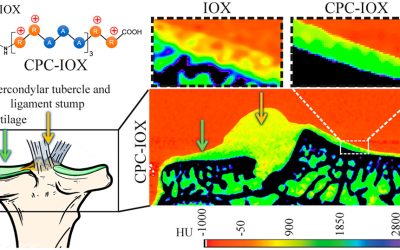 Contrast agent work featured in Northeastern Global News!